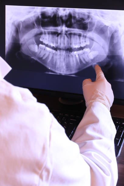 Best Urgent Care for Lost Fillings or Crowns in Barnesville, OH