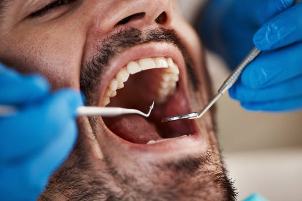 Best Emergency Dental Care for Broken or Chipped Teeth in Barnesville, OH